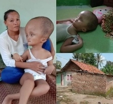 Miris, Anak Yatim Penderita Hidrosefalus ini Belum Sekalipun Dapat Bantuan Pemerintah 1 IMG_20200514_162357